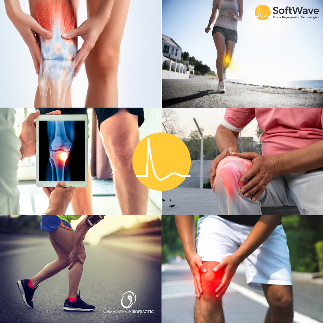 Knee Pain Relief Revolutionized: SoftWave Therapy vs. Steroid Injections